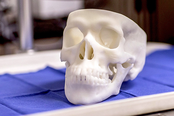 3D-printed skull